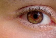 La blépharoplastie est-elle une opération remboursable ?