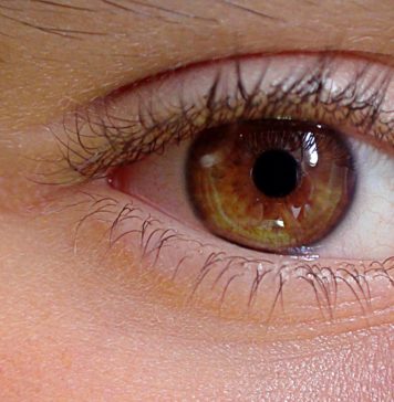 La blépharoplastie est-elle une opération remboursable ?