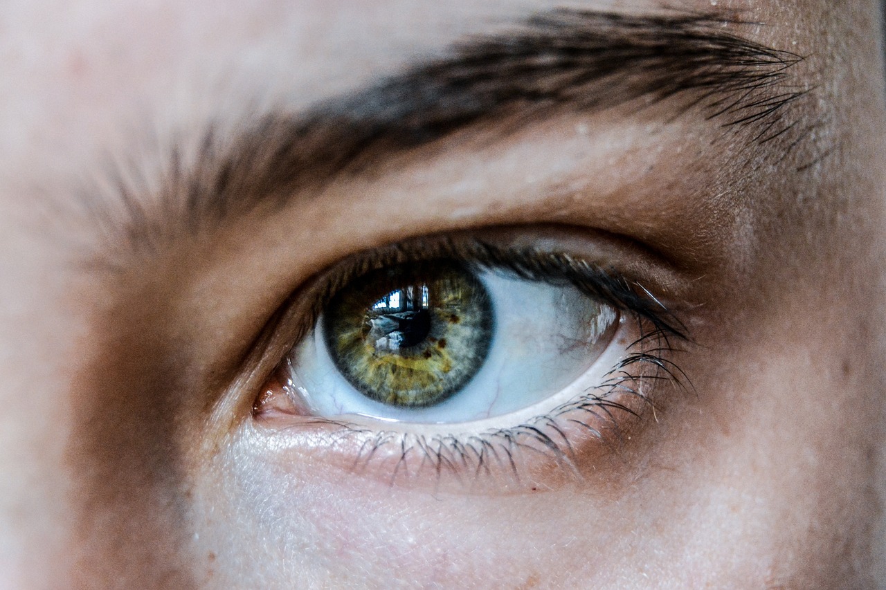 Blépharoplastie